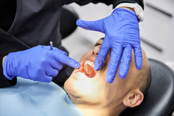 Best Broken or Chipped Tooth Repair in Mount Morris, MI